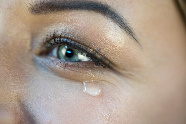 Ephiphora: What Causes Teary Eyes?