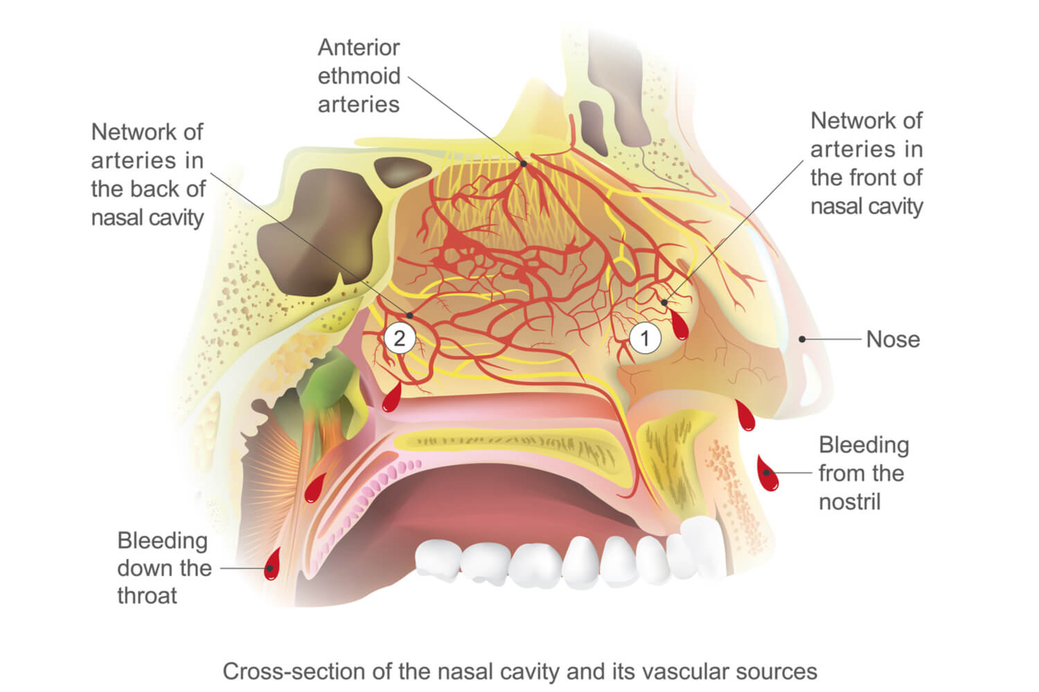 Nosebleeds Dr. Aykut Unsal Philadelphia